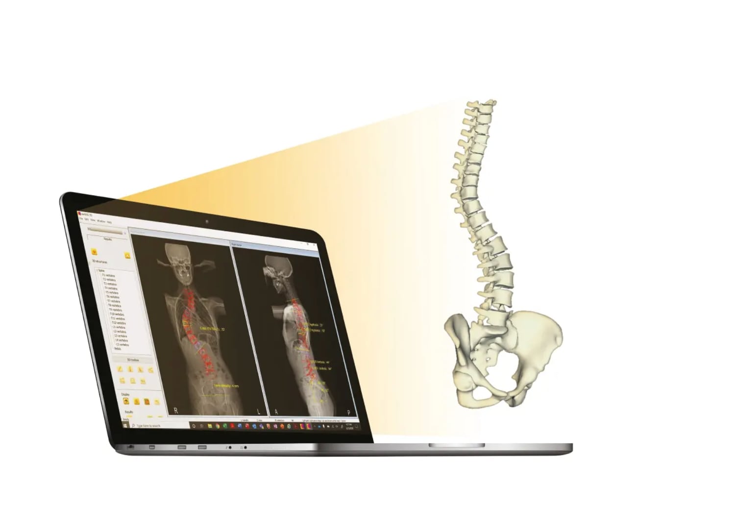 EOS Imaging