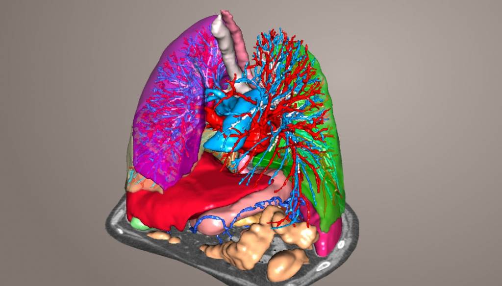 Modélisation 3D de l'anatomie d'un patient