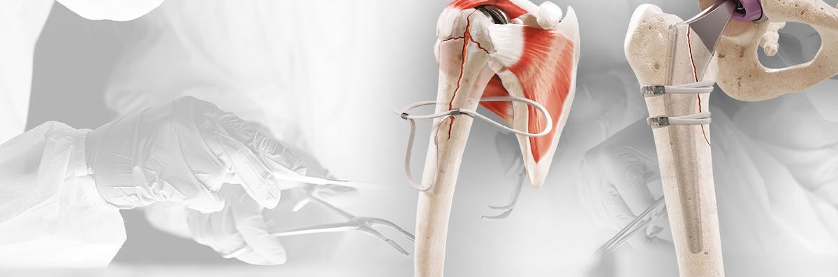 © FH Ortho
